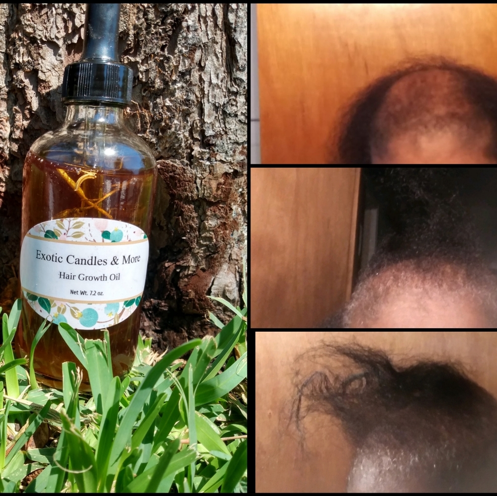 Hair Growth Oil